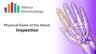 Rheumatology HAND exam Part 2 Inspection [upl. by Anik]