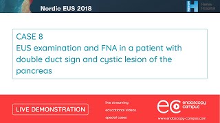 Livedemo  Nordic EUS 2018  EUS examination and FNA n a patient with double duct sign [upl. by Teilo]