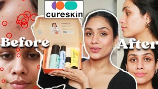 Honest Cureskin app review  Cureskin products  Look at the results 😨 [upl. by Eenolem581]