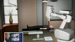 Cyberknife Redefines Radiation Treatment Phoenix Cyberknife amp Radiation Oncology Center [upl. by Alessig]