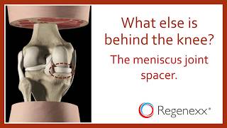 How to Tell if a Knee Injury is Serious  Yale Medicine Explains [upl. by Rodmun430]