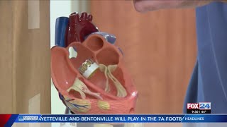 Baptist HealthFort Smith now offers TAVR procedure [upl. by Alleinad]