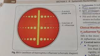 SATELLITISM IN HAEMOPHILUS INFLUENZAE [upl. by Ahsienyt]