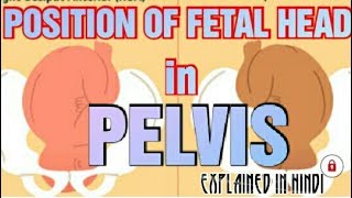 POSITION OF FETAL HEAD in PELVIS Explained in Hindi [upl. by Hellman]