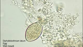 Diphyllobothrium latum egg [upl. by Samoht]