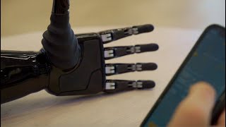 Manifesto Hand  Bionic Prosthetic Hand [upl. by Uzziel800]