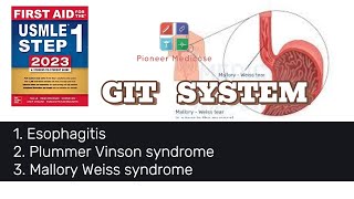 Esophagitis Mallory Weiss syndrome Boerhaave syndrome from first aid step 1UrduHindi [upl. by Cohn607]