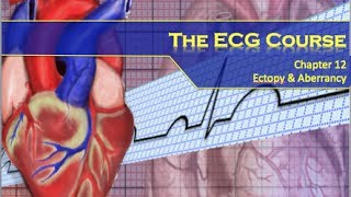 The ECG Course  Ectopy amp Aberrancy [upl. by Quartis111]