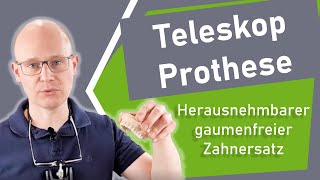 Teleskop Prothese Herausnehmbarer gaumenfreier Zahnersatz  Dr JensUwe Gössel [upl. by Lehcor]