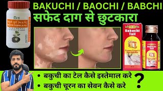 BAKUCHI OIL FOR VITILIGO  SBL BABCHI OIL KAISE KARE USE  PATANJALI BAKUCHI CHURAN  SAFED DAAG [upl. by Wj362]