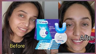 white bite pro teeth whitening kit for sensative teeth with LED light 35 carbamide peroxide [upl. by Nnylyaj]