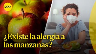 ¿Existe la alergia a las manzanas  Espacio vital [upl. by Gnah760]