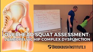 Overhead Squat Assessment Lumbopelvic Hip Complex Dysfunction [upl. by Derej]