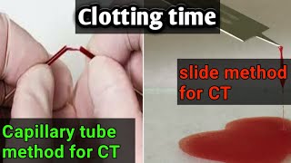 Blood Clotting time test capillary method tube and slide method coagulation profile lecture 3 [upl. by Stevana]