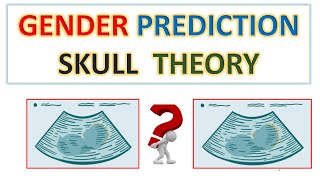 SKULL THEORY FOR GENDER PREDICTION  GENDER PREDICTION  BOY OR GIRL  BLUE OR PINK [upl. by Sebastien860]