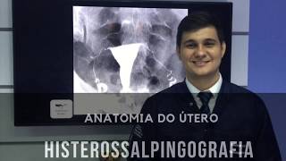 Anatomia do Útero  Histerossalpingografia  Radiologia Prática [upl. by Ecart]