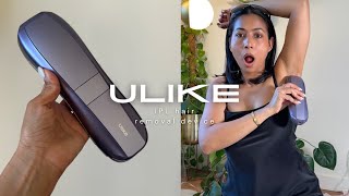 IPL Hair Removal Device on BrownDarker skin  ULIKE Air 10 [upl. by Annoik]