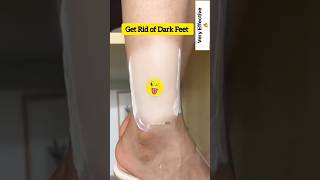 🔥Get Fair Feet  Easy Suntan Removal Pack At Home RemoveSuntan shortsytshortssuntandiyviral [upl. by Nidraj]