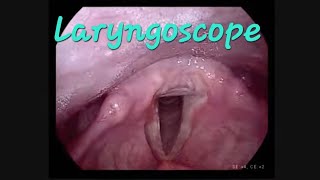 Laryngoscopy and stroboscope to examine the vocal cords  laryngoscope vocal test medical [upl. by Sura]