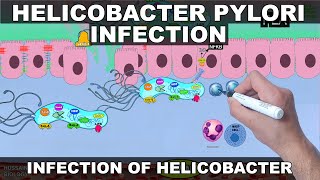 Helicobacter Pylori Pathogenesis  Detailed [upl. by Antoni259]