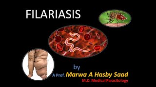 CBMPB Filariasis lect by AProf Marwa A Hasby [upl. by Romola]