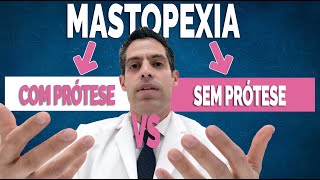 Mastopexia com prótese ou sem prótese qual a melhor [upl. by Donegan988]