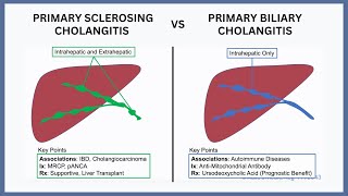 Primary Biliary Cholangitis vs Primary Sclerosing Cholangitis [upl. by Pelligrini]