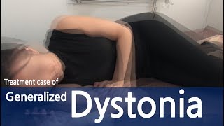 Generalized Dystonia  Abdominal dystonia  Immediate response within first treatment  전신 사경증 [upl. by Ciardap245]