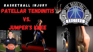 Basketball Injury Patellar Tendinitis vs Jumpers Knee [upl. by Nohsyar]