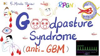 Goodpasture Syndrome  AntiGlomerular Basement Membrane AntiGBM Antibody Disease  Nephrology [upl. by Nylyrehc]