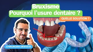 Bruxisme dentaire  comment identifier et traiter efficacement [upl. by Neit]