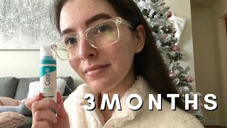 I Used Cerave Retinol for 3 Months  Photos  Update [upl. by Bala19]