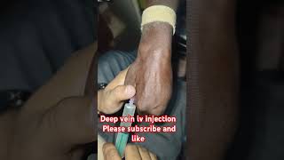 Deep veins injection trending shorts video drxsachin12 [upl. by Kristos]