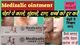 Medisalic ointment cream uses side effects [upl. by Odericus747]