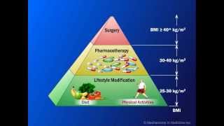 Current Management of Obesity [upl. by Ydahs]