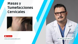 Masas y Tumefacciones en Cuello  LinfomasAdenopatias [upl. by Moyra]