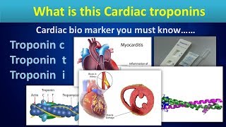 What is this Cardiac troponinsCardiac bio markers in Myocardial ischemia [upl. by Reinaldos]