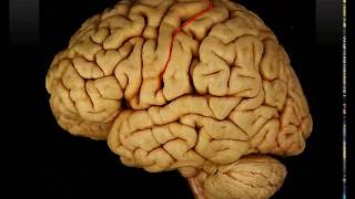 Sulci and Gyri of Lateral Surface of the Cerebral Hemisphere Practical  Dr Ahmed Farid [upl. by Vanderhoek]