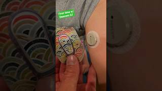 Lillian’s First Dexcom G7 diabetes dexcom t1d cgm dexcomg7 type1diabetes [upl. by Nerehs]