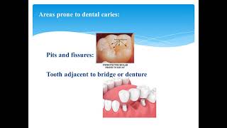 Lec 10 epidemiology of dental caries video [upl. by Hsuk150]