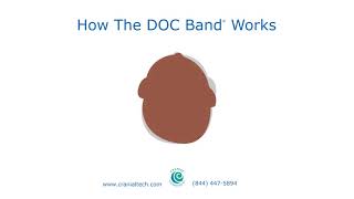 How The DOC Band® Works [upl. by Edecrem]