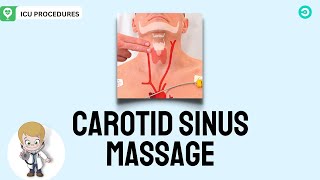 Carotid Sinus Massage What is it and How to perform the procedure [upl. by Antonina]