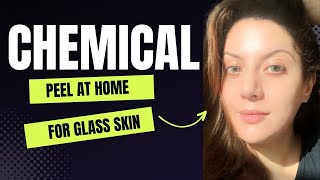 How to do a Chemical peel at home I How to use peeling solution the ordinary  Nipun Kapur [upl. by Bena130]