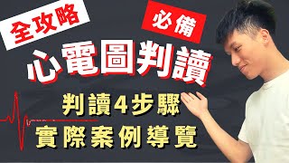 【4步驟搞定心電圖判讀】ECG EKG Reading實際案例導覽！ACLS、心律不整、心房顫動、心室顫動、房事阻斷、課後測驗！醫學生臨床值班必備技能！十二導程心電圖、心臟電氣生理、心臟傳導！ [upl. by Ymeraj]