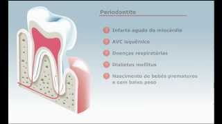 O Periodonto  Periodontuscombr [upl. by Gnoix]