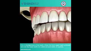 Youre not alone in your journey to a perfect smile Let us help you realign at Thind Dental Clinic [upl. by Ihab]