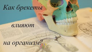 Как брекеты влияют на остальной организм [upl. by Yennor]