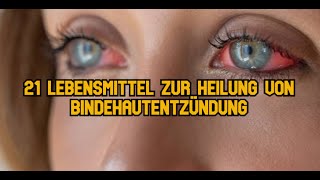 21 Lebensmittel zur Heilung von Bindehautentzündung [upl. by Nivram]