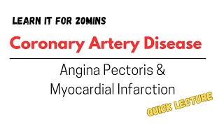 Atherosclerosis Angina Pectoris and Myocardial Infarction lecture discussion [upl. by Orips]