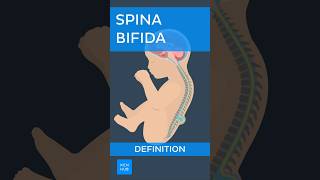 Spina bifida Definition  Kenhub spinabifida [upl. by Mcgraw]